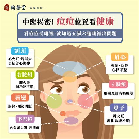 痘痘長的位置代表什麼|青春痘、下巴痘痘長這個位置代表什麼意思？先弄懂長。